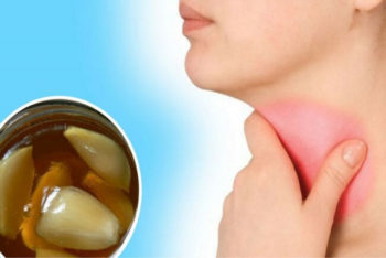 Os 5 remédios caseiros que te ajudarão a aliviar a dor de garganta