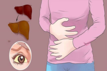 7 sinais de alerta de que seu fígado está com muita gordura acumulada e como tratar