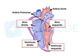 Taquicardia ventricular: o que é, sintomas, causas e tratamento – Tua Saúde